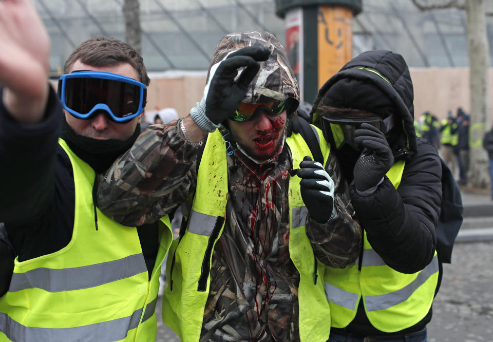 A demonstrator wearing a yellow vest is covered in blood after getting in injured during a protest in Paris, Saturday, Dec. 8, 2018. (Photo: Thibault Camus/AP)