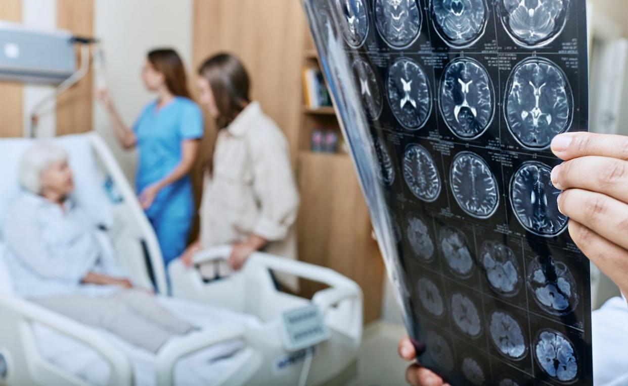 MRI of head of elderly woman in hands of doctor standing in medical ward near senior patient with relative and nurse.