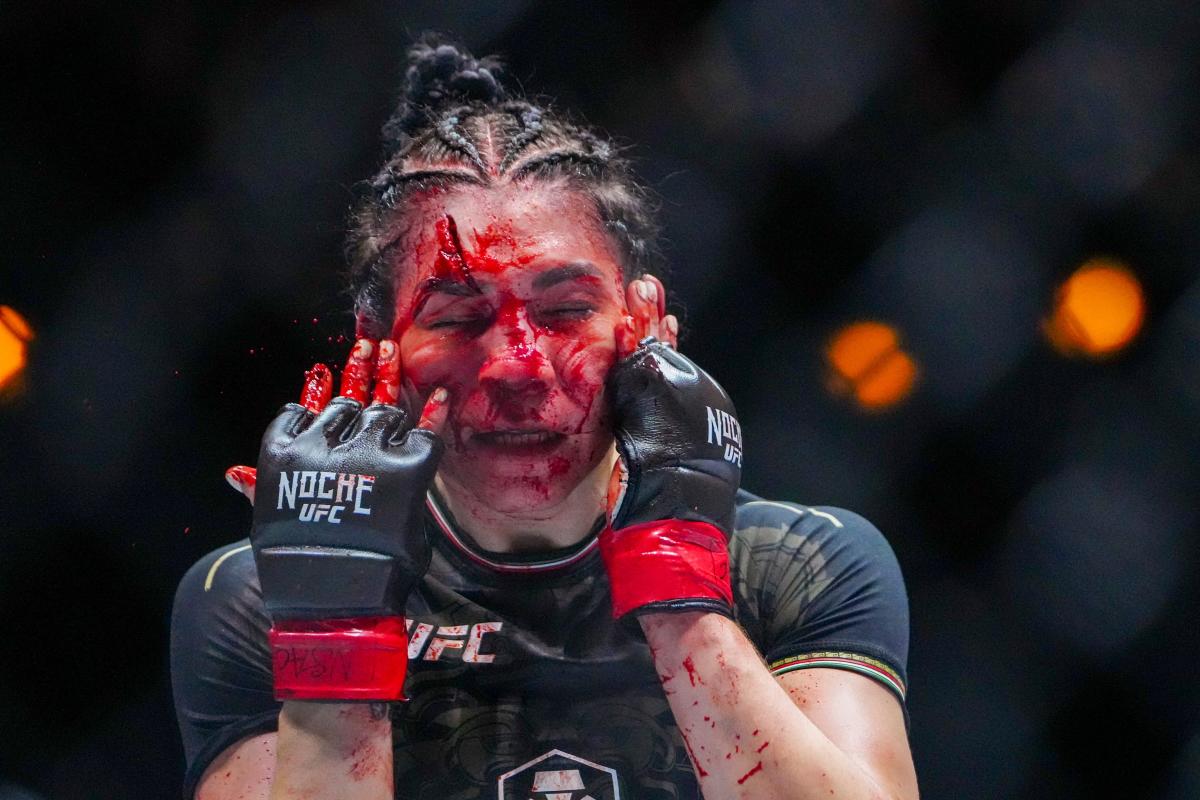 Norma Dumont unsurprised UFC 306 fight vs. Irene Aldana wasn’t stopped – despite grotesque cut