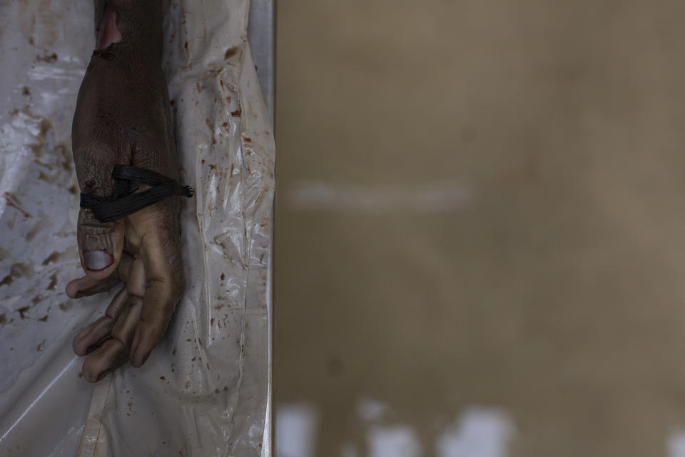 In this Monday, April 16, 2018 photo, the hand of an unidentified man is seen at a mortuary in the Hillbrow neighborhood of Johannesburg during forensic examination. When undocumented migrants die and nobody claims their body, there's no collection of them in any national or international tally. (AP Photo/Bram Janssen)