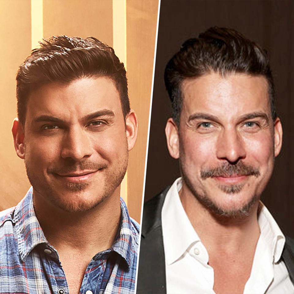 Jax Taylor then and now (Getty Images / Bravo)