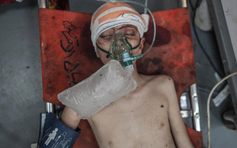 A Palestinian boy injured in Israeli bombardment receives treatment at Al-Aqsa Martyrs Hospital in Deir el-Balah, central Gaza.