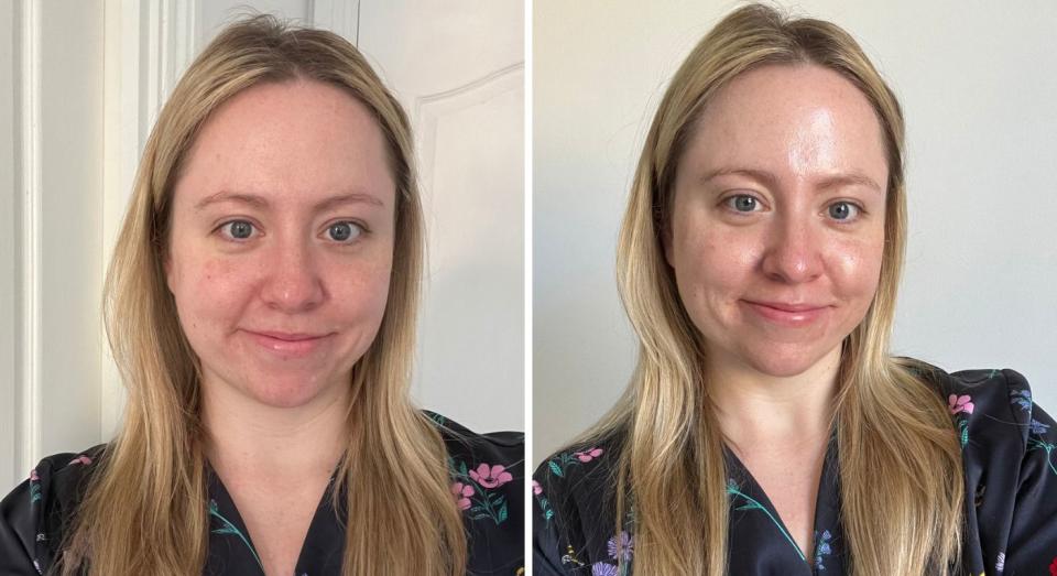 One the left is before and on the right is after applying it. I love how it creates an instant glowy, dewy finish on my skin. (Yahoo Life UK)