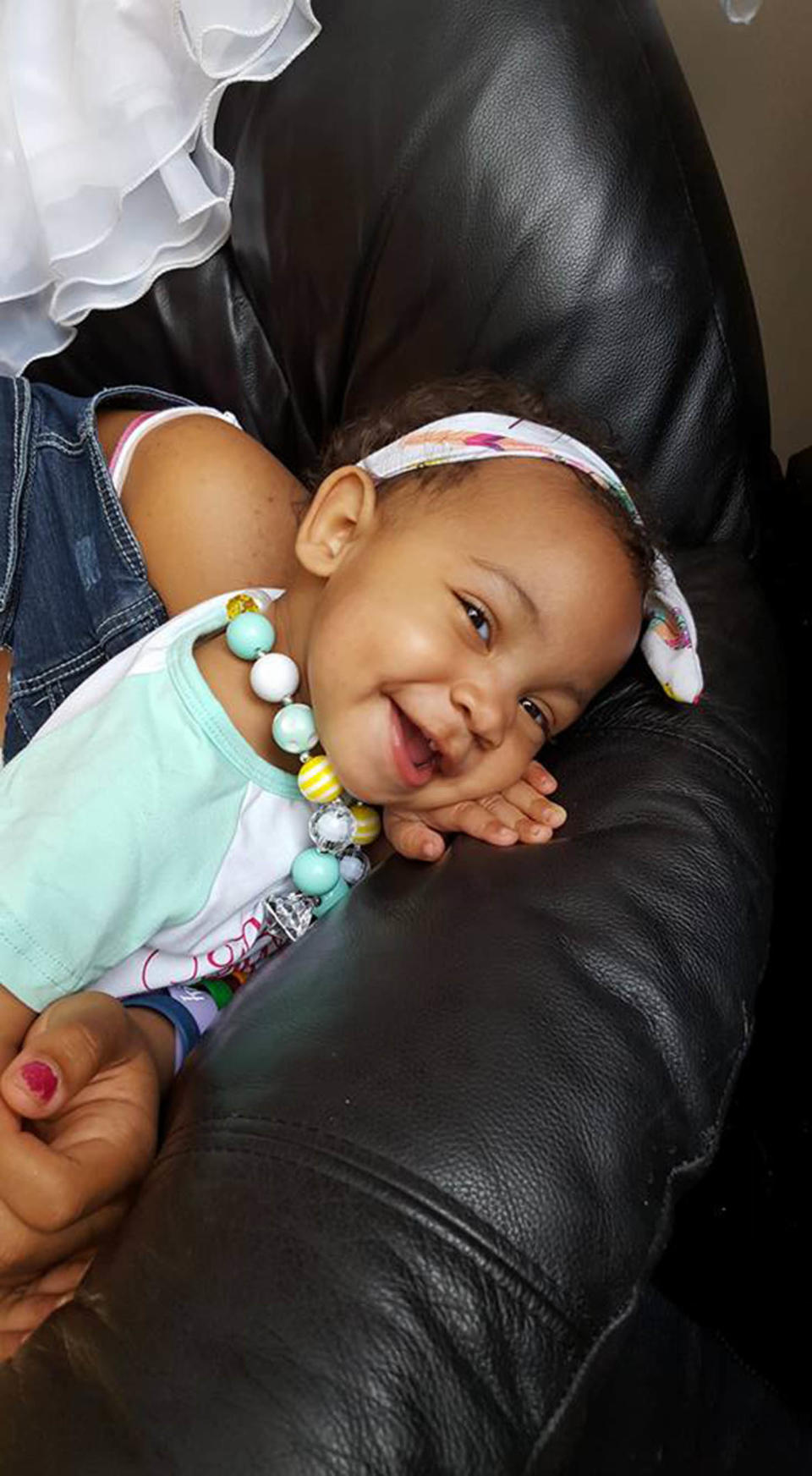 "Our daughter, Azariah, was dignosed with bilateral Wilms tumor on June 9, 2015 at 10 weeks old. She had 12 weekly rounds of chemo (VAD) and surgery on September 22, 2015, through which they where able to save most of her right kidney and one third of her left. She's been cancer free since November. <br /><br />She suffered a bowel obstruction (an unfortunate side effect of her abdominal surgery) in January of this year when we she went septic. <strong>We almost lost her twice, once due to the sepsis and then again due to her temporary central line dislodging and fluids causing her to swell so much it was restricting her airway</strong>. Happy to say that today she is doing amazing and is full of wonder! She makes us laugh every single day!" -- Sarah Omari Idaeho