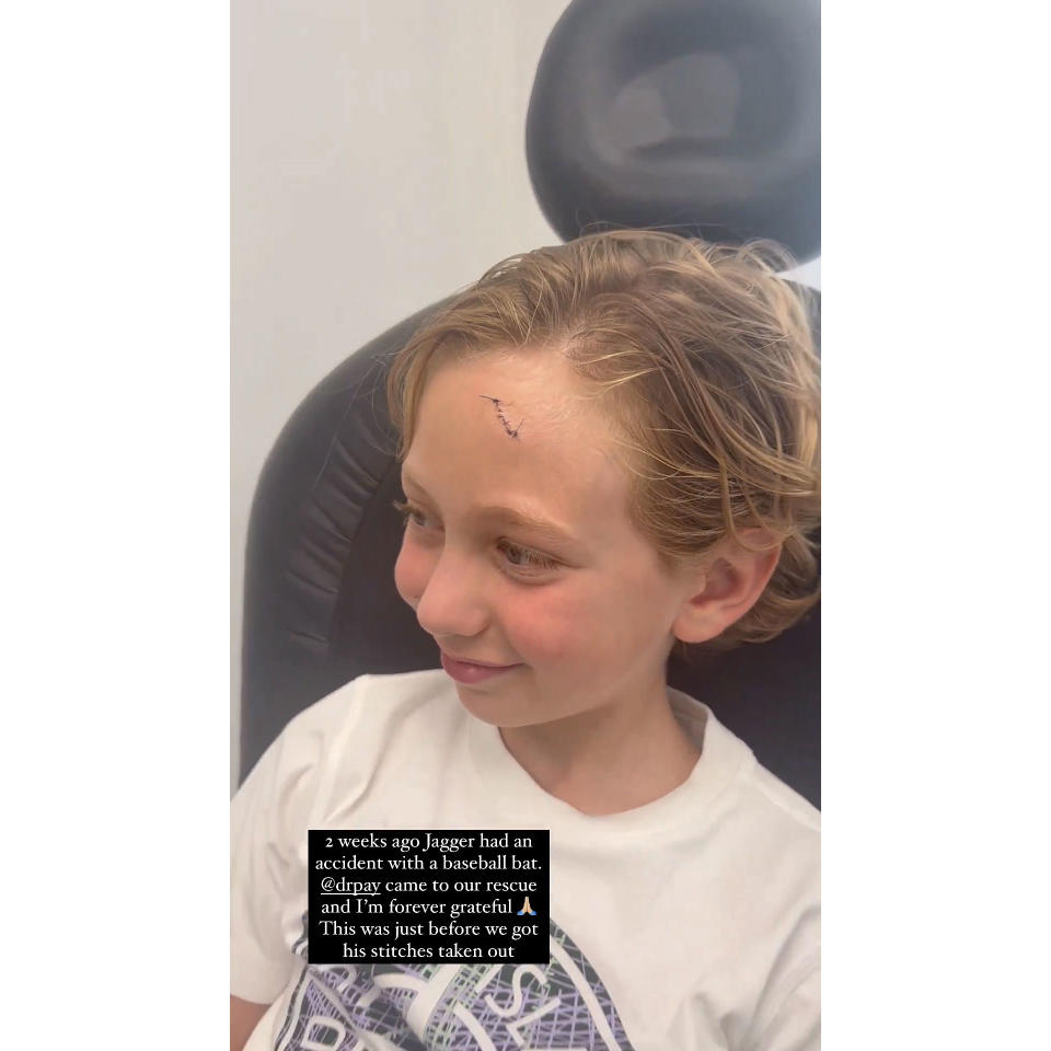 Dorit Kemsley Reveals Son Jagger Got Stitches After Baseball Bat Accident 2