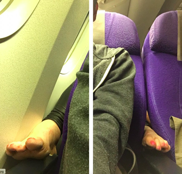 The offending feet. (Photo: Reddit/craftiest)