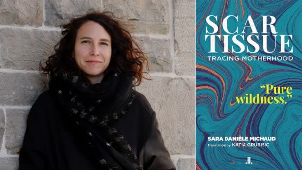 Scar Tissue is a book by Sara Danièle Michaud, left, and translated by Katia Grubisic. 