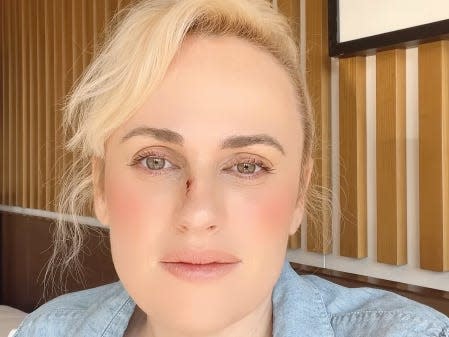 rebel wilson in a denim shirt with her hair pulled back, a scabbed over injury visible on her nose