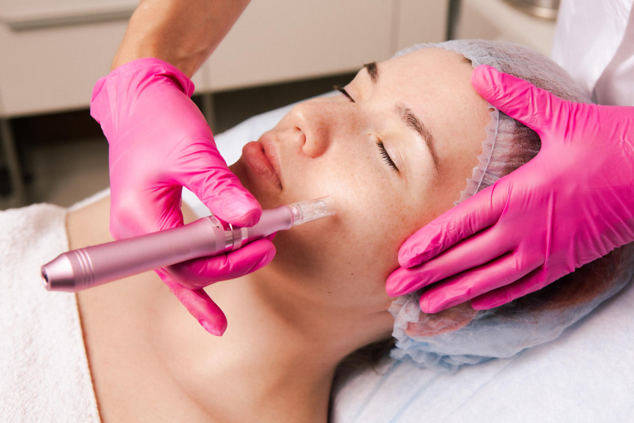 A person wearing medical gloves does a microneedling cosmetic procedure on a woman’s cheek.