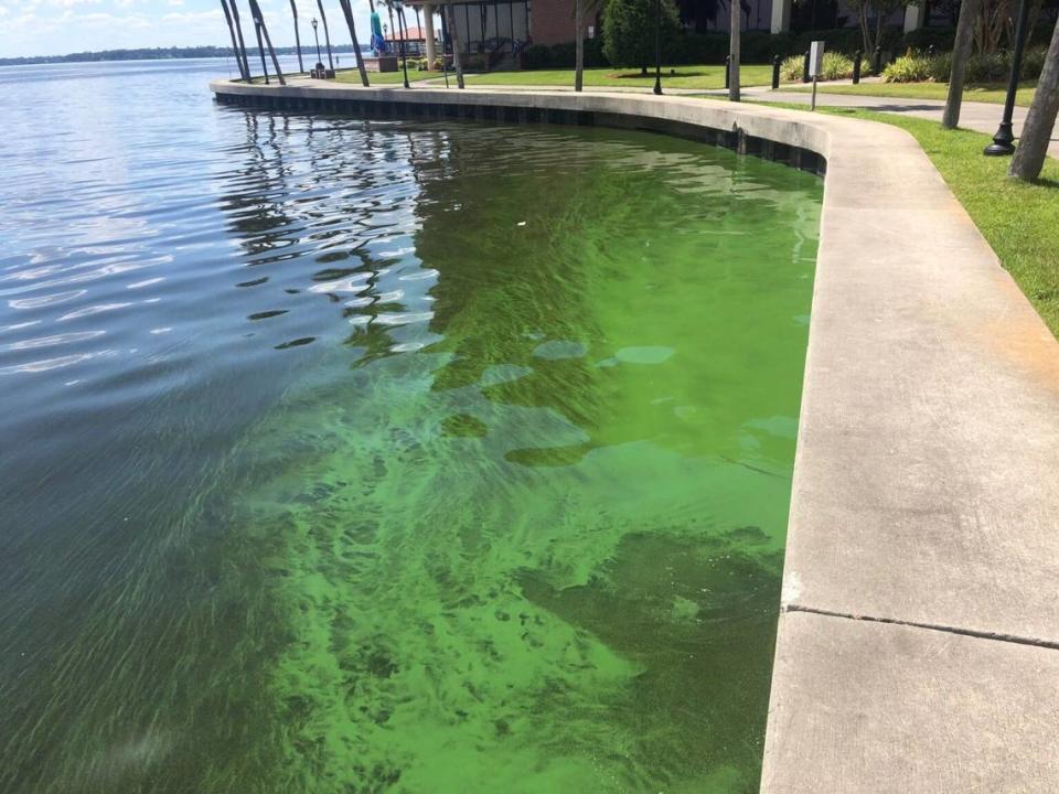 Una floración de algas en 2021 en el Hospital Ascension St. Vincent's Riverside en Jacksonville.