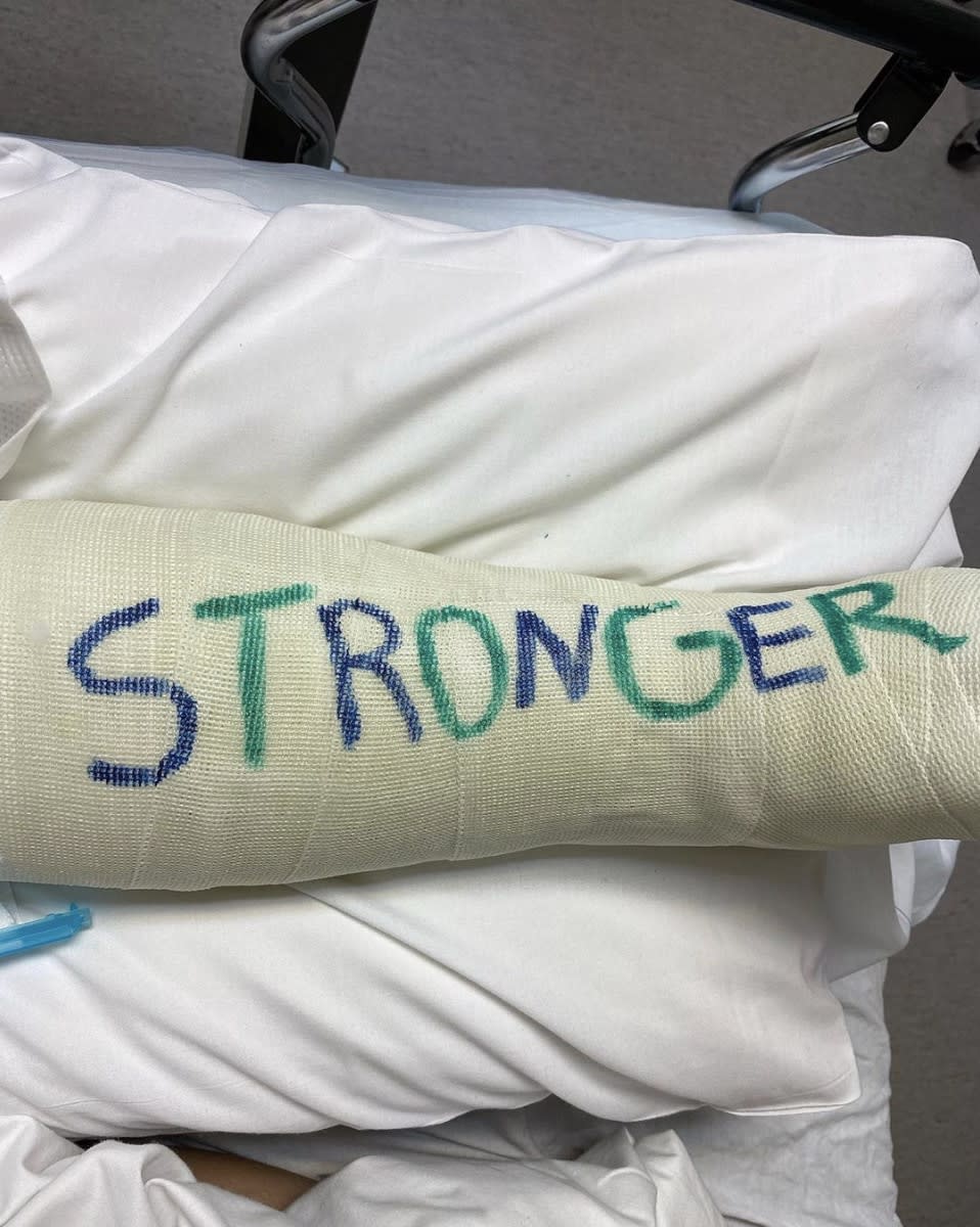 Britney Spears will be sporting a cast on her leg for a little while after breaking her metatarsal bone on her foot. Boyfriend Sam Asghari shared a sweet caption on his Instagram for her: "When you break something it tends to heal stronger specially when you're my girl...wishing her the best recovery so she can jump, run, and dance her butt off."