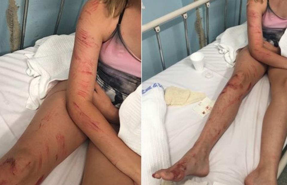 <em>Bloodied and bruised – Myrthe was sucked through a rocky passageway (Pictures: Yahoo7 News/Esther Lammertink)</em>