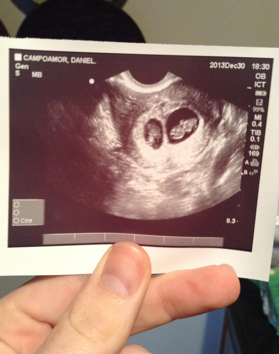 The first ultrasound and confirmation of the author's twin pregnancy. (Courtesy Danielle Campoamor)
