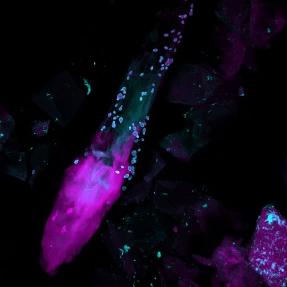 Human skin is host to a diverse array of microbes. Shown here are fungi (cyan) surround a human hair (yellow) within the skin.