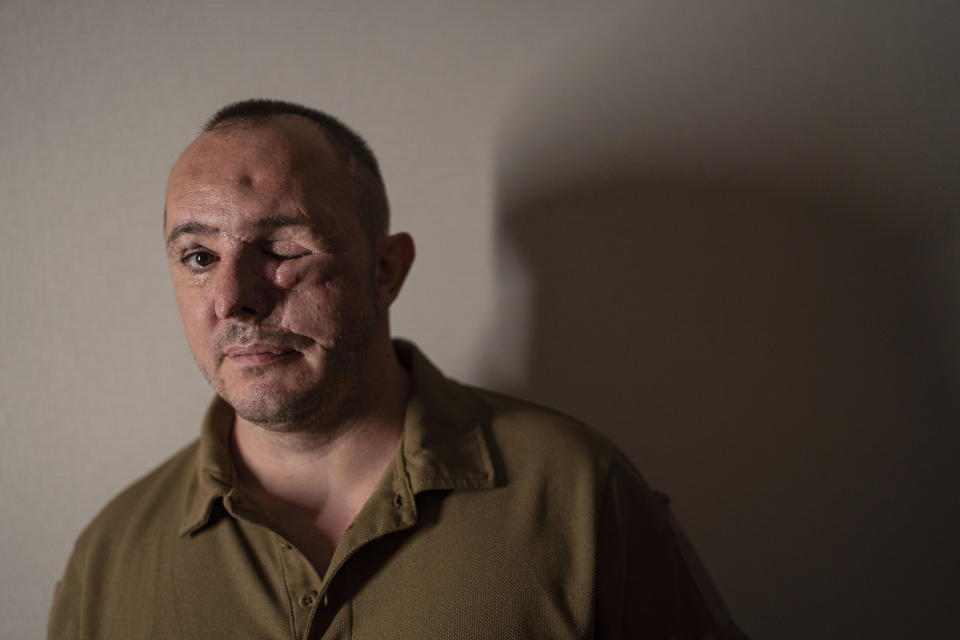 Roman Belinskiy, a 43-year-old Ukrainian army veteran, poses for a photo at home in Kolomyia, Ukraine, Friday, July 21, 2023. Belinsky, a stormtrooper from the 14th brigade, fought near Kyiv and then in the Zaporizhzhia region. Ukraine is facing the prospect of a future with upwards of 20,000 amputees, many of them soldiers who are also suffering psychological trauma from their time at the front. (AP Photo/Evgeniy Maloletka)