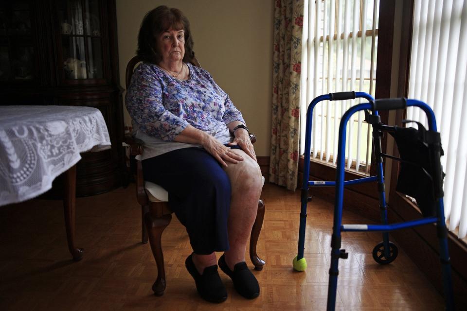 Roberta Musto is in her home Monday, July 18, 2022 in Callahan. Musto had a total left knee replacement in November of 2019. Her lawsuit against Dr. Richard David Heekin, his clinic and St. Vincent's Riverside said Heekin ruptured the patella tendon and tried to repair it but failed. Musto has settled the suit against Heekin and his clinic, but the claims against the hospital are still in court. The hospital has denied the claims.