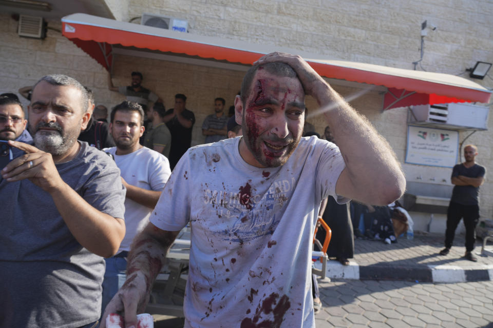 A Palestinian man wounded in an Israeli air strike arrives at al-Aqsa Hospital in Deir el-Balah City, Gaza Strip, Saturday, Oct. 14, 2023. (AP Photo/Hatem Moussa)