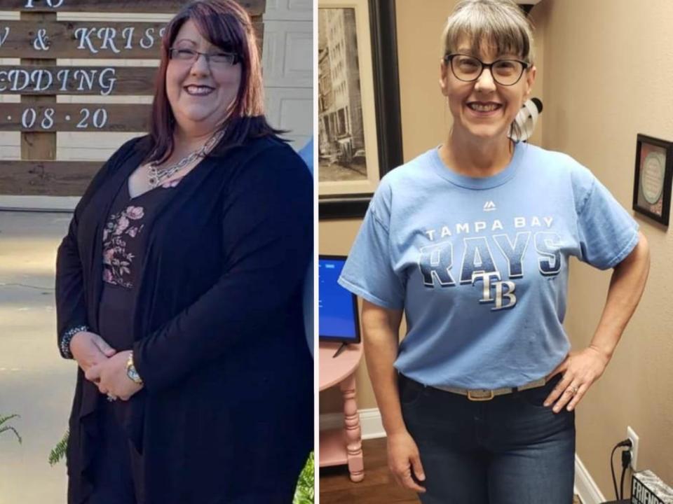 before and after pictures show Tara Rothenhoefer's weight loss of 176 pounds