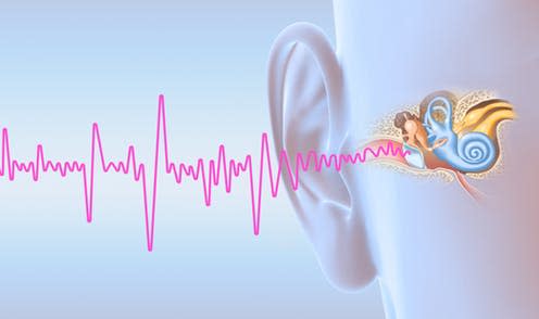 <span class="caption">Tinnitus is characterised by hearing unwanted sounds, like ringing or buzzing. </span> <span class="attribution"><a class="link " href="https://www.shutterstock.com/image-illustration/tinnitus-human-ear-middle-otitis-auditory-1320955337?src=Aj9FlzxG-t6y17FN0XDOHg-1-1" rel="nofollow noopener" target="_blank" data-ylk="slk:Alex_Kock/ Shutterstock;elm:context_link;itc:0;sec:content-canvas">Alex_Kock/ Shutterstock</a></span>