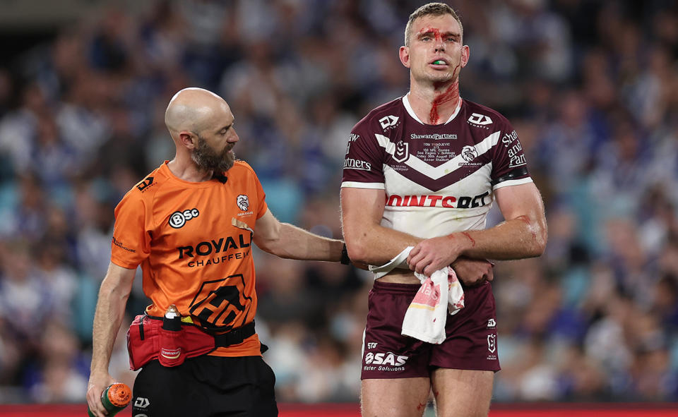 Tom Trbojevic, pictured here after picking up a shoulder injury.