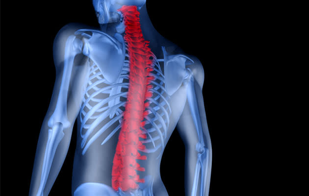 Ankylosing spondylitis can affect males and females as young as 20 years old. (Thinkstock photo)