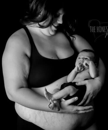 A group of women have bared their postpartum bodies to encourage others to love theirs.