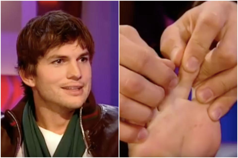 <p>Sí, Ashton Kutcher tiene dos dedos de los pies unidos como desveló en el programa de Jonathan Ross. (Foto: BBC). </p>