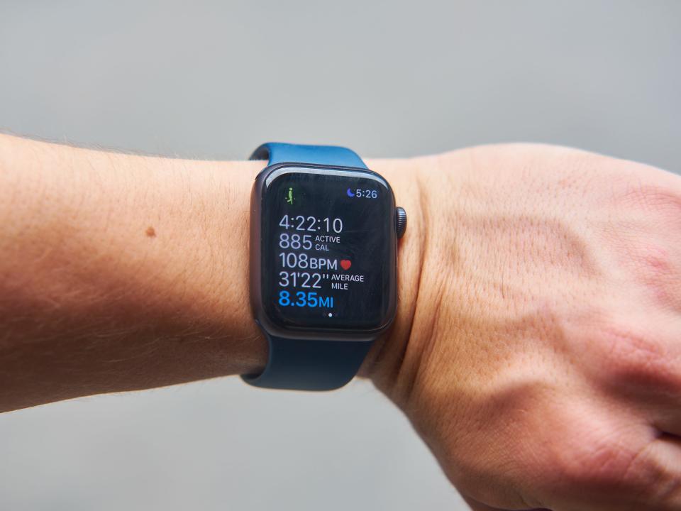 Arm with an Apple Watch