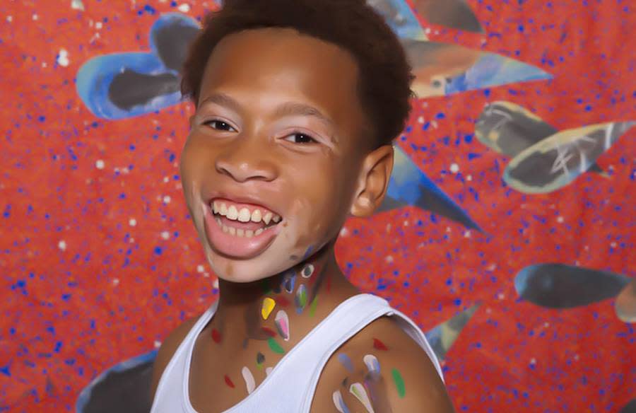 Stunning Portraits Perfectly Capture the Beauty of People Living With Vitiligo