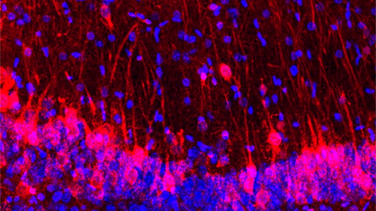  Microscopic image of mouse and rat brain cells shows cells labeled in red and blue on dark background. 