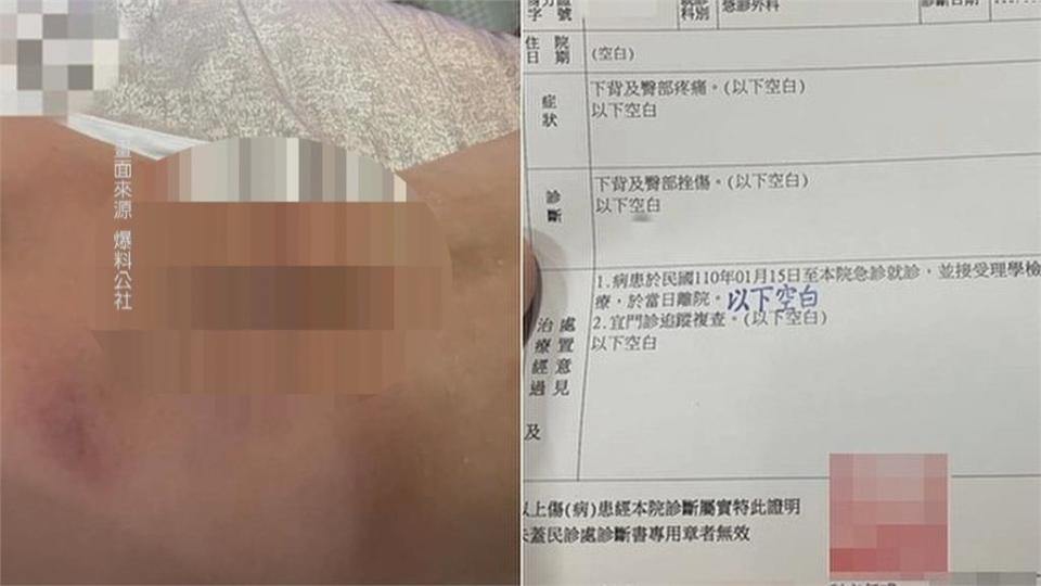 按摩浴缸會吸人！女子背部大片瘀青 女子po網求公道 業者實測表示不解