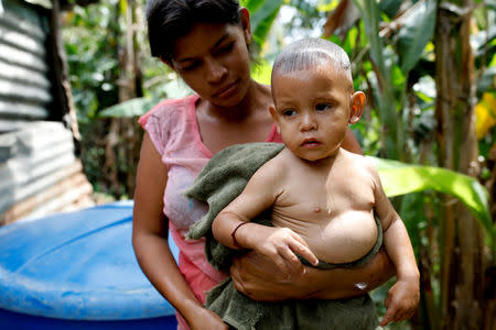 Maria Guitia carries her son Yeibe Medina after bathing him at home near San Francisco de Yare, Venezuela, February 18, 2019. REUTERS/Carlos Garcia Rawlins