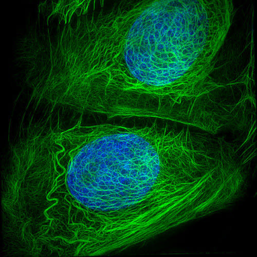 Two skin cells about to separate.  DNA is pictured in blue. 