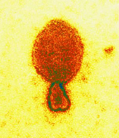 專家擔憂，致死率高達75%的立百病毒（Nipah virus）有造成大流行的風險。（CSIRO@Wikipedia/CC BY 3.0）