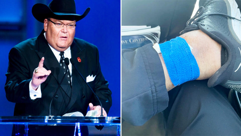 Jim Ross, pictured here revealing he's been diagnosed with skin cancer again.