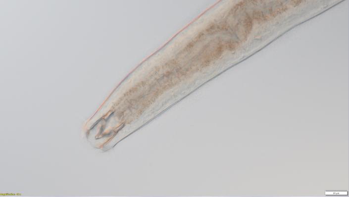 Imagen microscópica de un nematodo metoncholaimus.