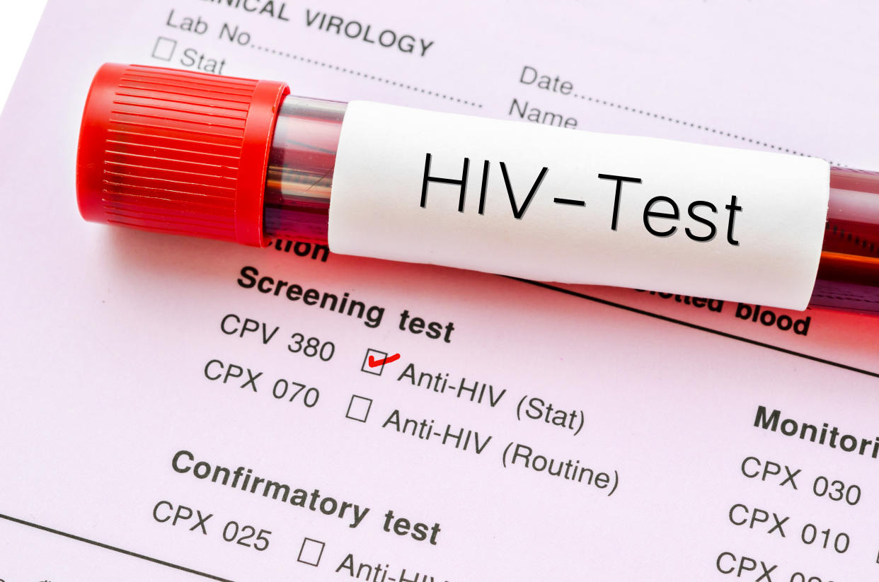 Sample blood collection tube with HIV test label on HIV infection screening test form.