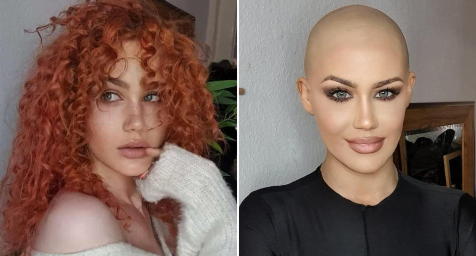 Kimberley Findeis-Sparkes with her red curly hair and no hair while going through chemotherapy. 