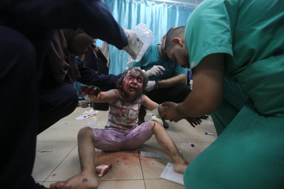 A wounded Palestinian child is treated at Al-Aqsa Hospital in Gaza (AP)