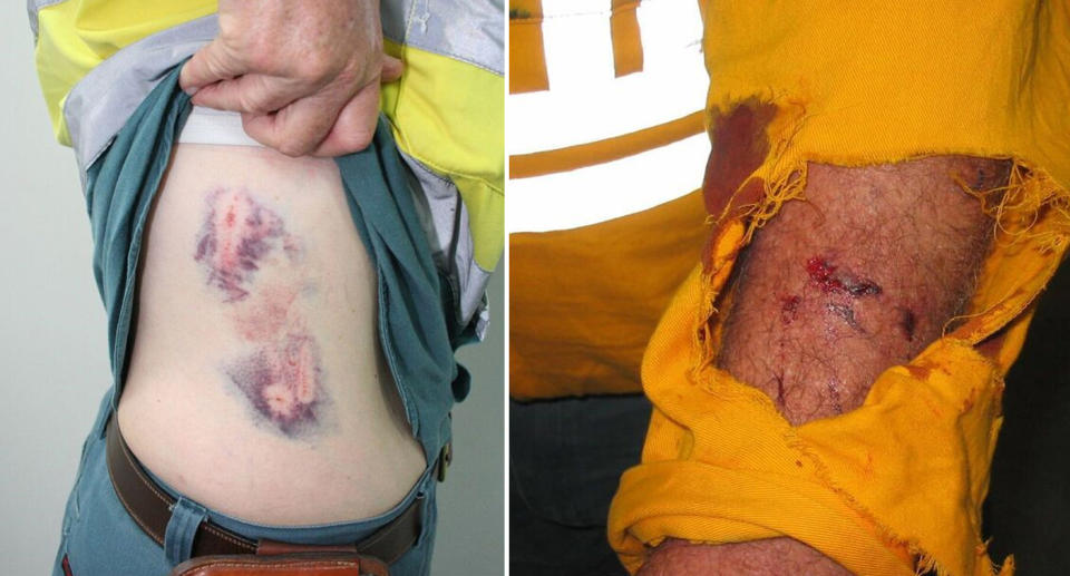 Workers have suffered dog bite injuries (pictured) while checking Queensland properties. 