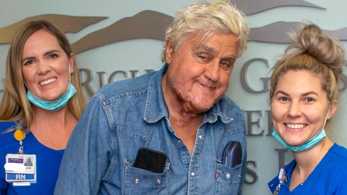 Jay Leno révèle des brûlures dues au feu, sorti de l’hôpital