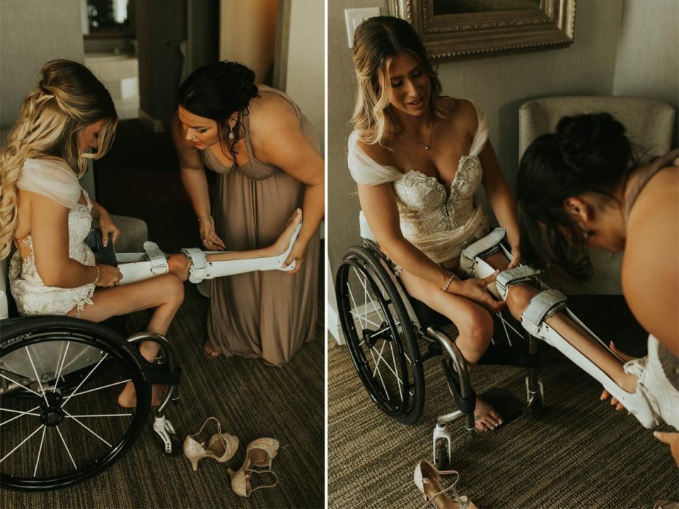 Two images of a woman helping a woman sitting in a wheelchair put on leg supports.