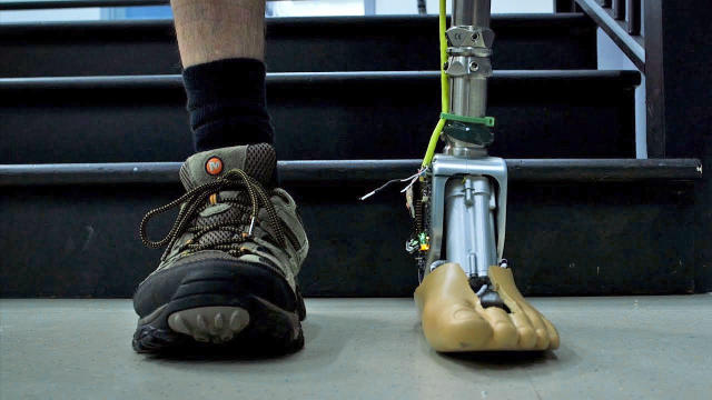 Smart prosthetic ankle can adapt to uneven ground