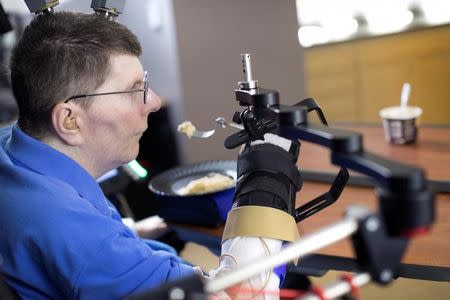 Bill Kochevar, 56, is using computer-brain interface technology and an electrical stimulation system to move his own arm after eight years of paralysis, in this undated handout photo. Case Western Reserve University/Cleveland FES Center/Handout via REUTERS