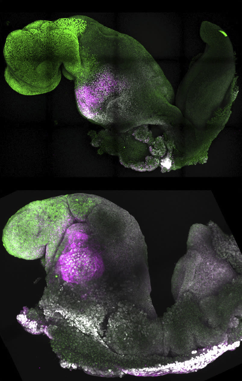 This combination of microscope images provided by researchers Gianluca Amadei and Charlotte Handford in August 2022 shows natural, top, and synthetic mouse embryos with colors added to show comparable brain and heart formation. According to a study published in the journal Nature on Thursday, Aug. 25, scientists have created “synthetic” mouse embryos from stem cells without a dad's sperm or a mom's egg or womb. (Gianluca Amadei, Charlotte Handford via AP)