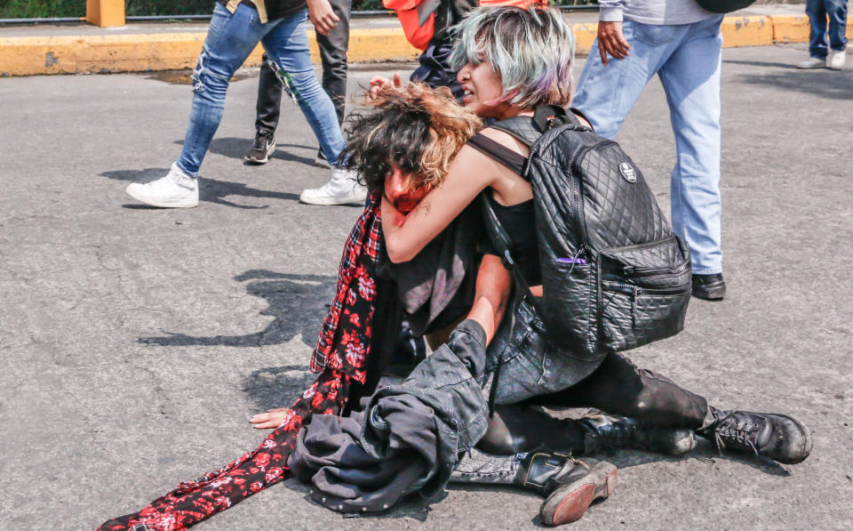 Joel Meza García resultó gravemente durante los actos violentos de un grupo de porros en Ciudad Universitaria el pasado lunes 3 de septiembre. <a href="https://www.huffingtonpost.com.mx/2018/09/06/y-quien-es-naomi-la-heroina-que-salvo-a-joe-de-los-porros-en-la-unam_a_23519109/" rel="nofollow noopener" target="_blank" data-ylk="slk:Naomi, su novia;elm:context_link;itc:0;sec:content-canvas" class="link ">Naomi, su novia</a>, lo protegió con su cuerpo. (Foto de Diego Uriarte vía HuffPost México)