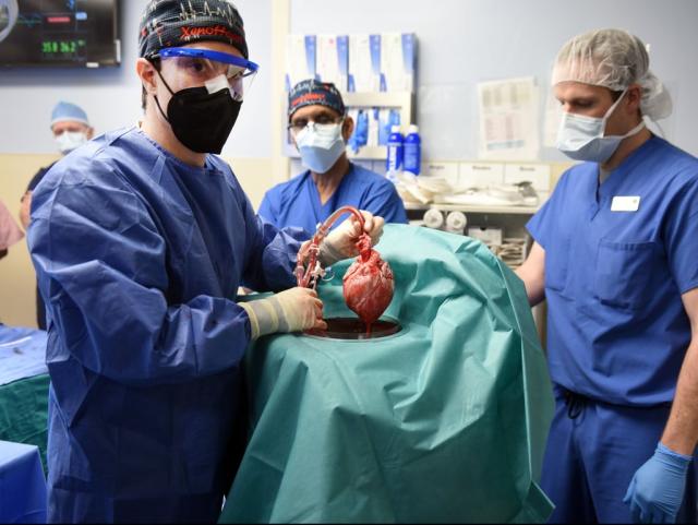 Surgeons implant the heart of a genetically modified pig into a human as part of a life-saving operation. (University of Maryland School of Medicine)