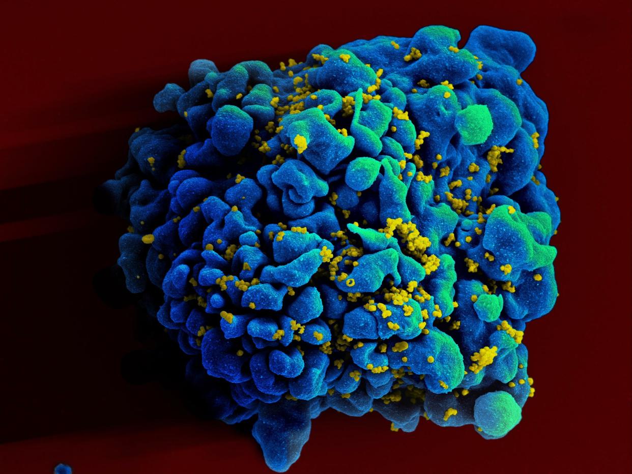 Scanning electromicrograph of an HIV-infected H9 T cell stained blue and green, with small yellow excrescences. 