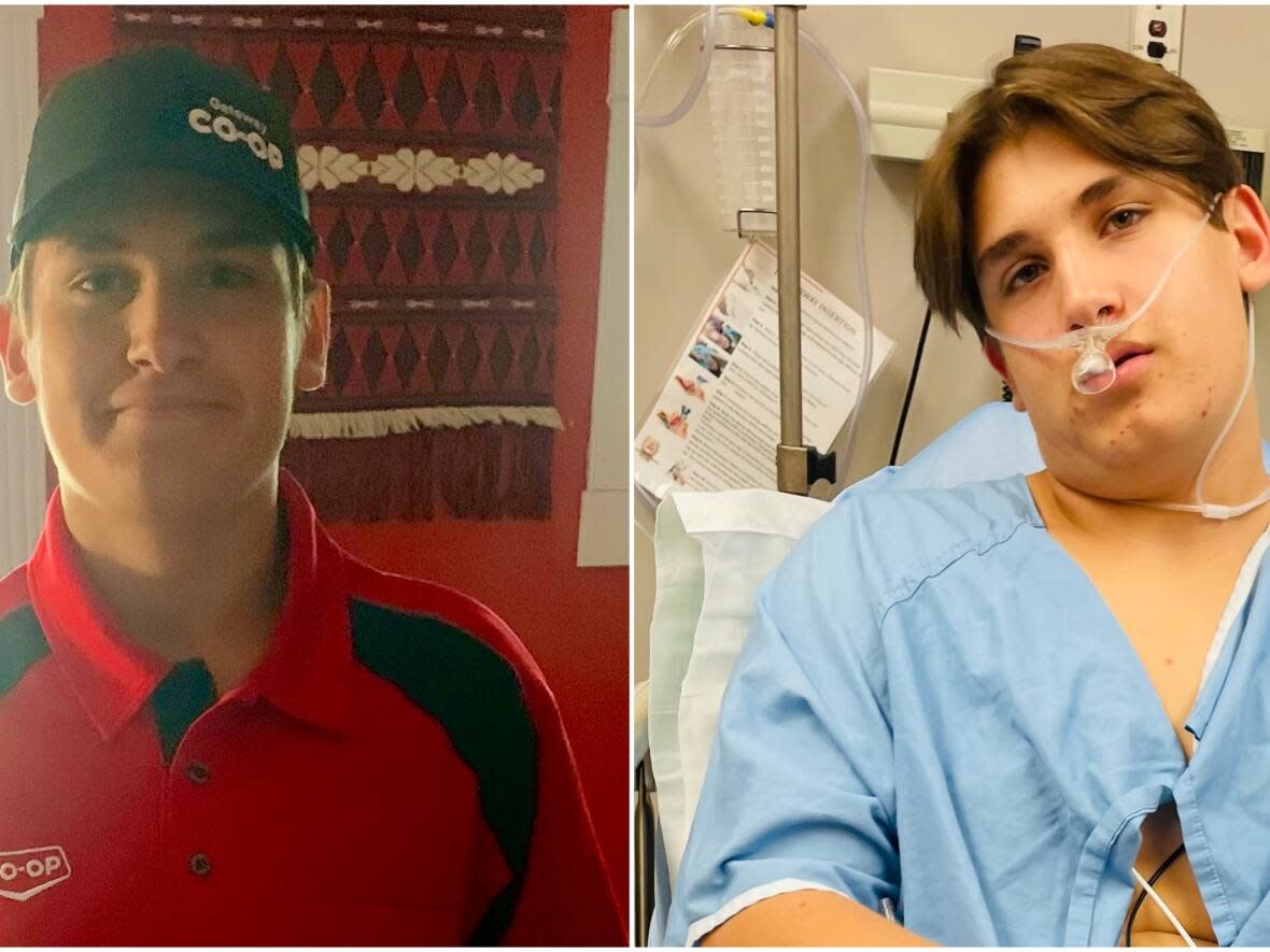 At left, Wil Krotenko is seen on Aug. 1, 2023, his first day on the job at the Co-op grocery store in Canora, Sask. At right, he is seen a few months later after being airlifted to an Edmonton hospital with a severe case of carbon monoxide poisoning that happened at work. (Submitted by Kelly Krotenko - image credit)