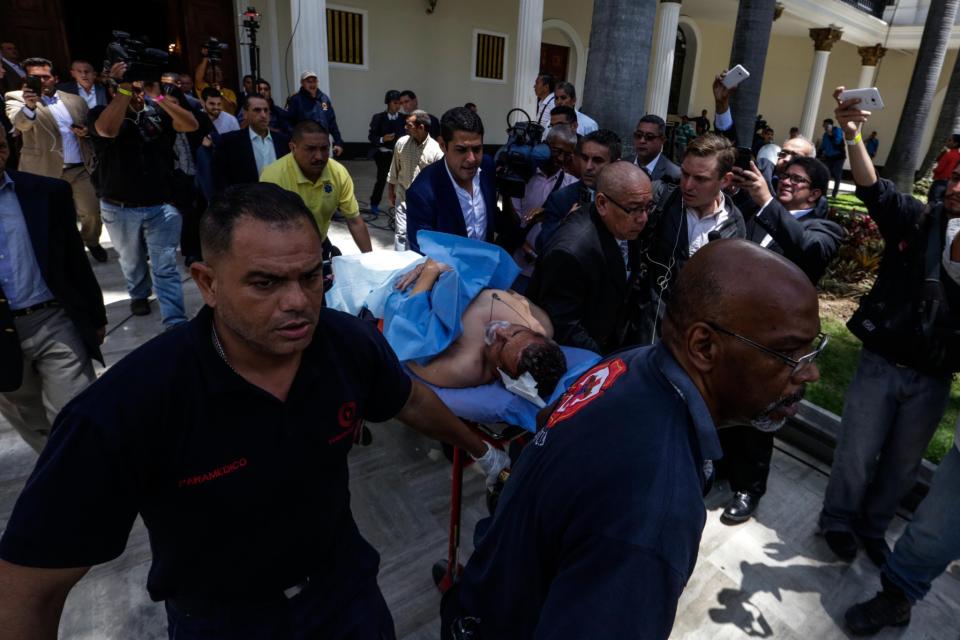 El diputado Américo de Grazia fue evacuado en una ambulancia tras enfrentamientos en la Asamblea Nacional el miércoles 5 de julio de 2017, en Caracas (Venezuela). Un grupo de simpatizantes del Gobierno venezolano irrumpió hoy por la fuerza en la Asamblea Nacional (AN, Parlamento), de mayoría opositora, y causó heridas a algunos diputados que se encontraban en el recinto para una sesión en conmemoración del Día de la Independencia en el país. (EFE/CRISTIAN HERNÁNDEZ)